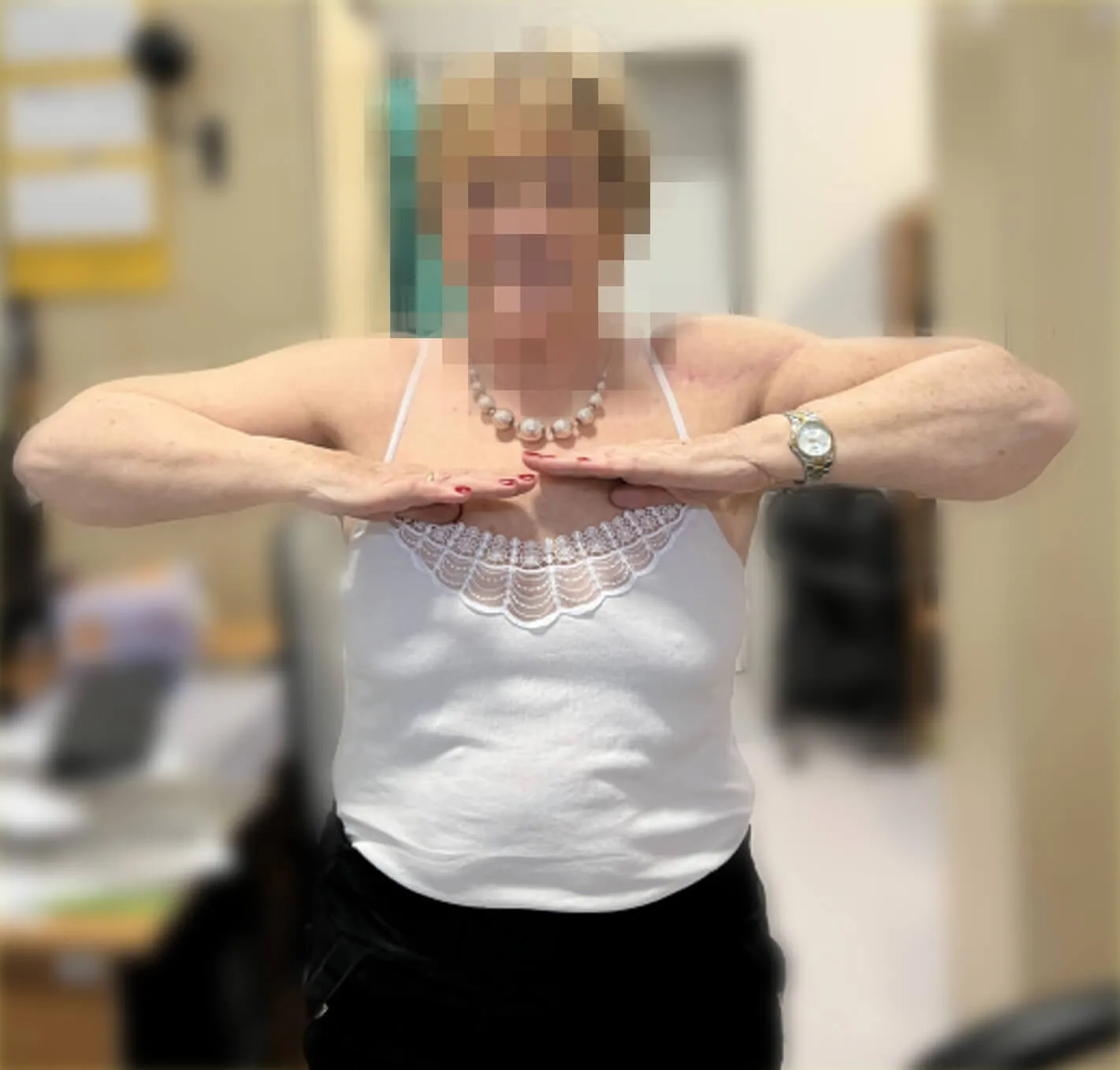 Zakres ruchu 4 miesiące po operacji